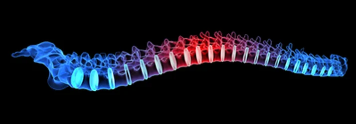 chiropractic care for sciatica and back pain